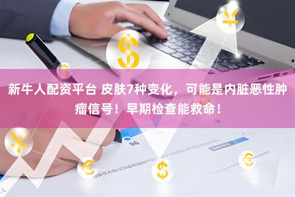 新牛人配资平台 皮肤7种变化，可能是内脏恶性肿瘤信号！早期检查能救命！